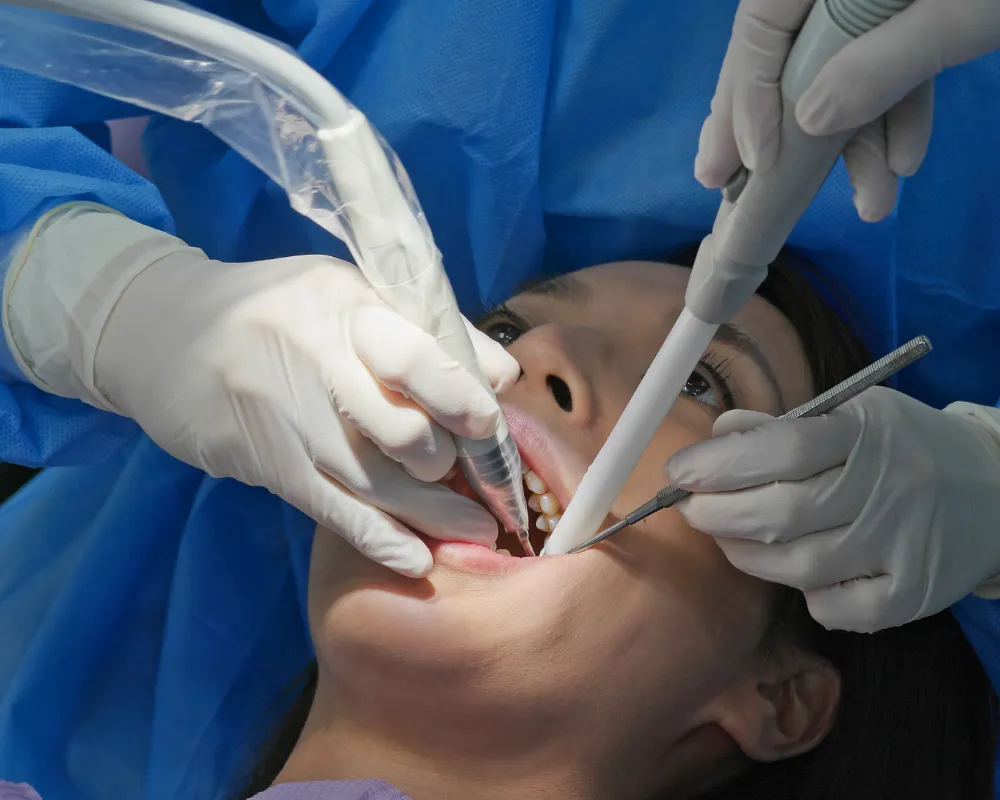 what is a root canal
