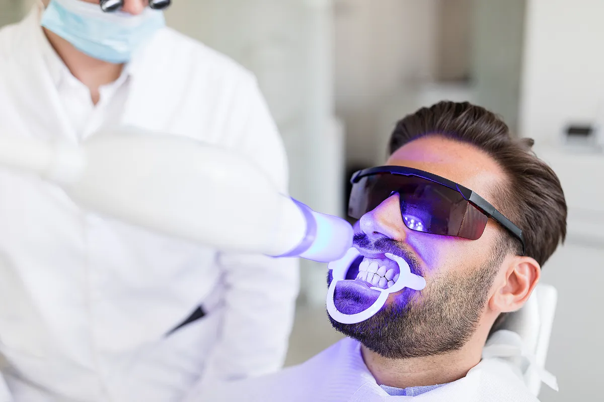 Professional Teeth Whitening how to whiten your teeth