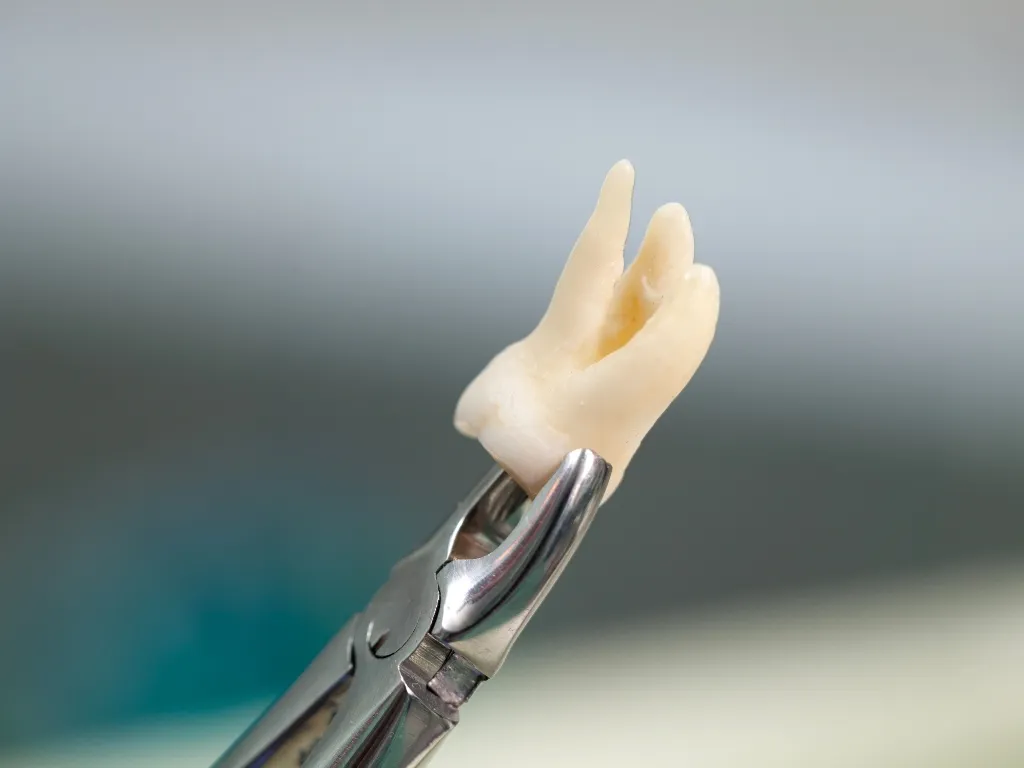 How to Care for Your Stitches How to Care for Your Stitches