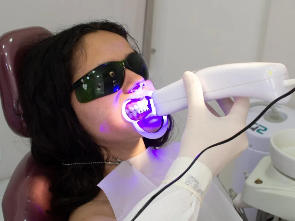 Key Factors That Influence Your Whitening Results Key Factors That Influence Your Whitening Results