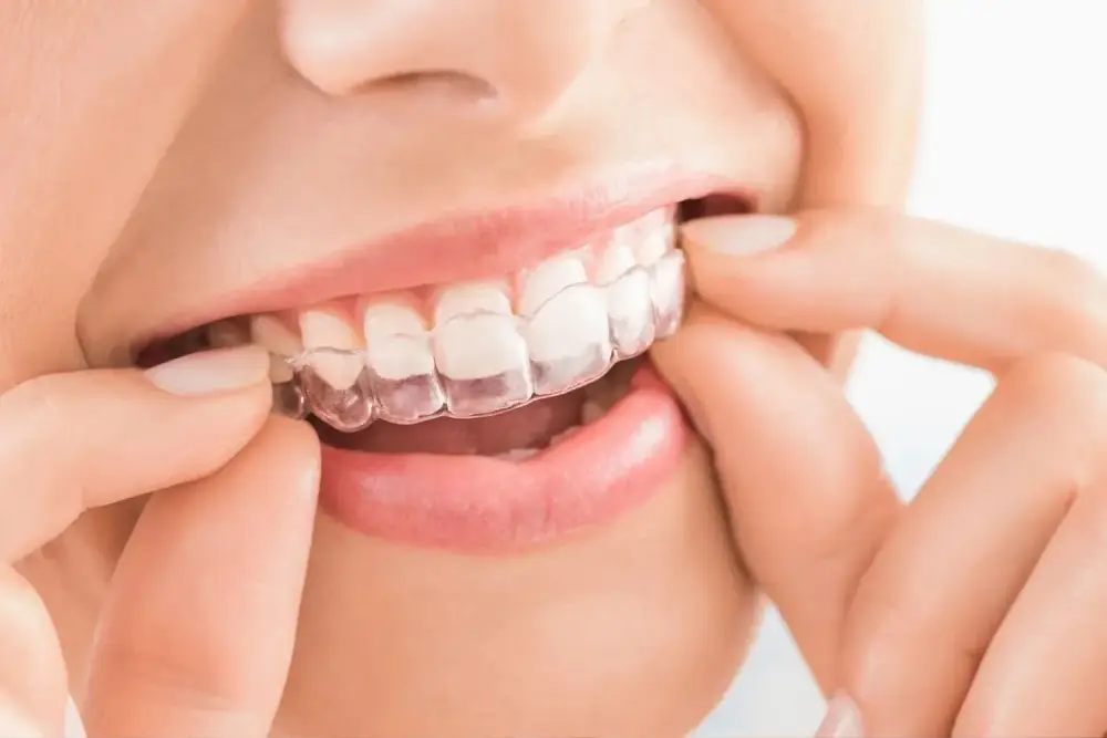 gum free tips forest manor dental gum free tips forest manor dental