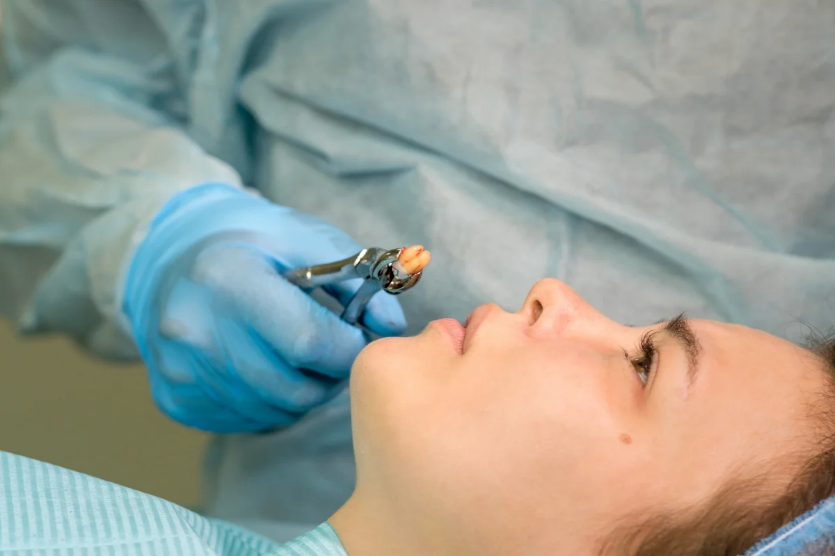 Dentists Try to Save Natural Teeth First Dentists Try to Save Natural Teeth First