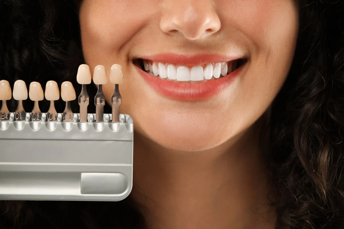 Porcelain Veneers vs. Composite Bonding Porcelain Veneers vs. Composite Bonding
