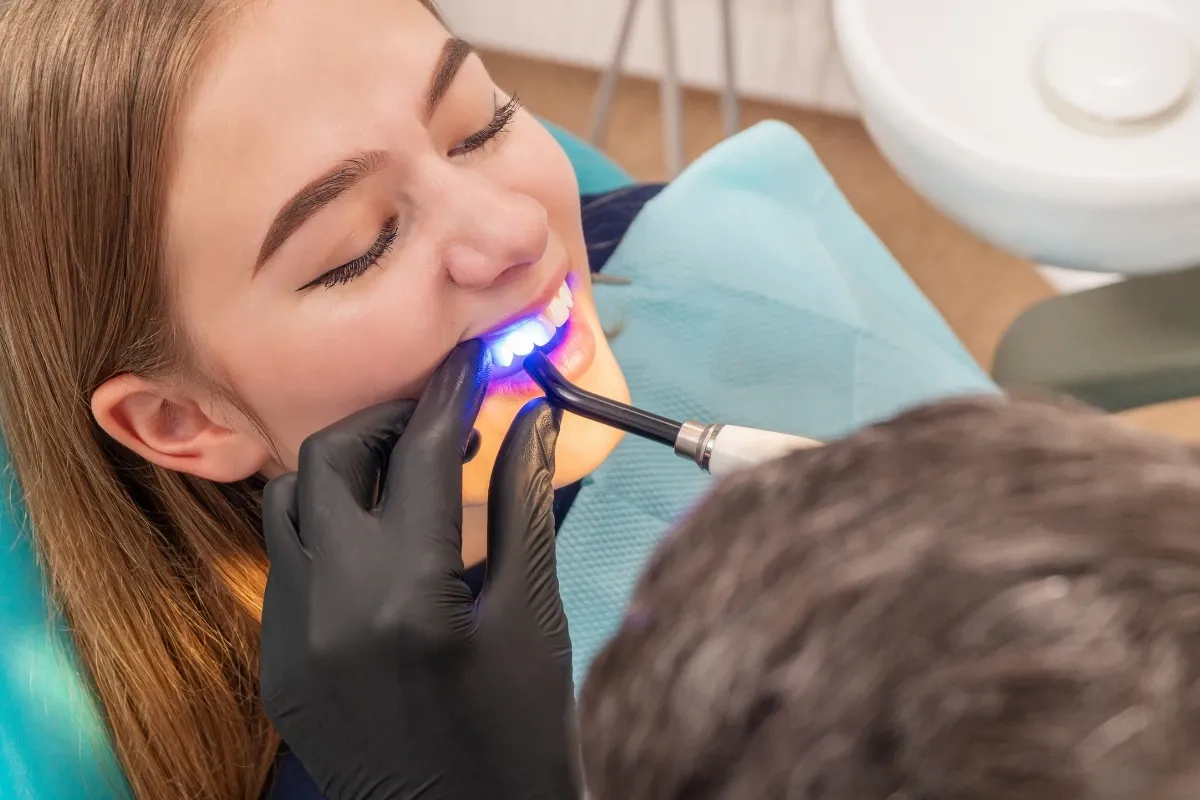 What Are Porcelain Veneers What Are Porcelain Veneers